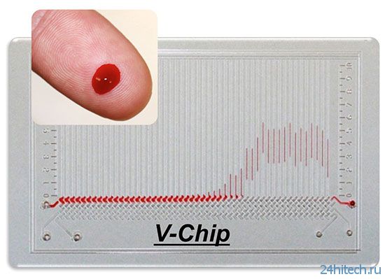 V-Chip - лаборатория в кармане