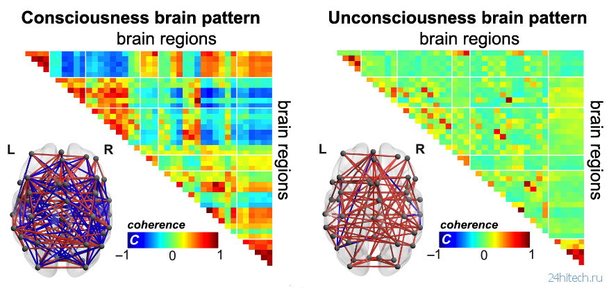 Ученые определили «неврологические паттерны» сознания