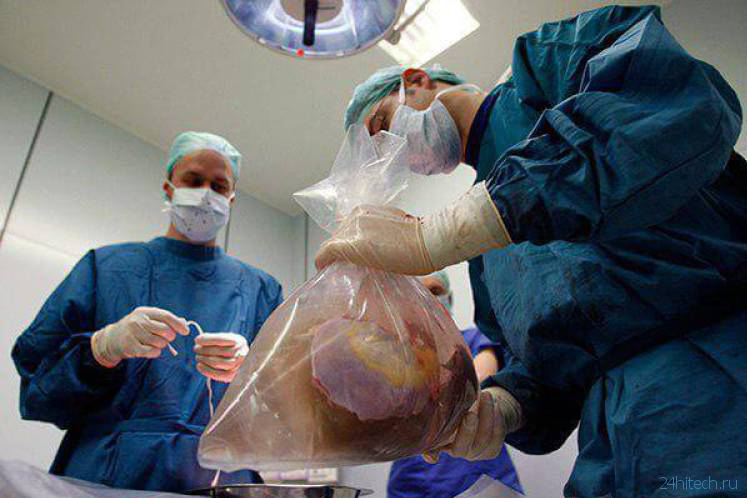 Как долго органы для трансплантации могут находиться вне тела?