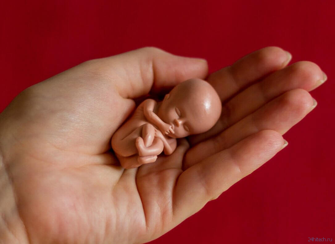 Как аборты влияют на эмоциональное состояние женщин?
