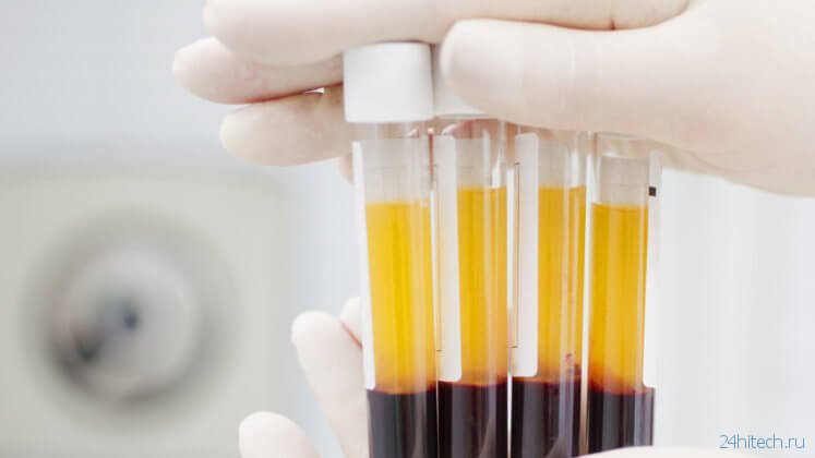 Может ли переливание плазмы крови вылечить коронавирус?