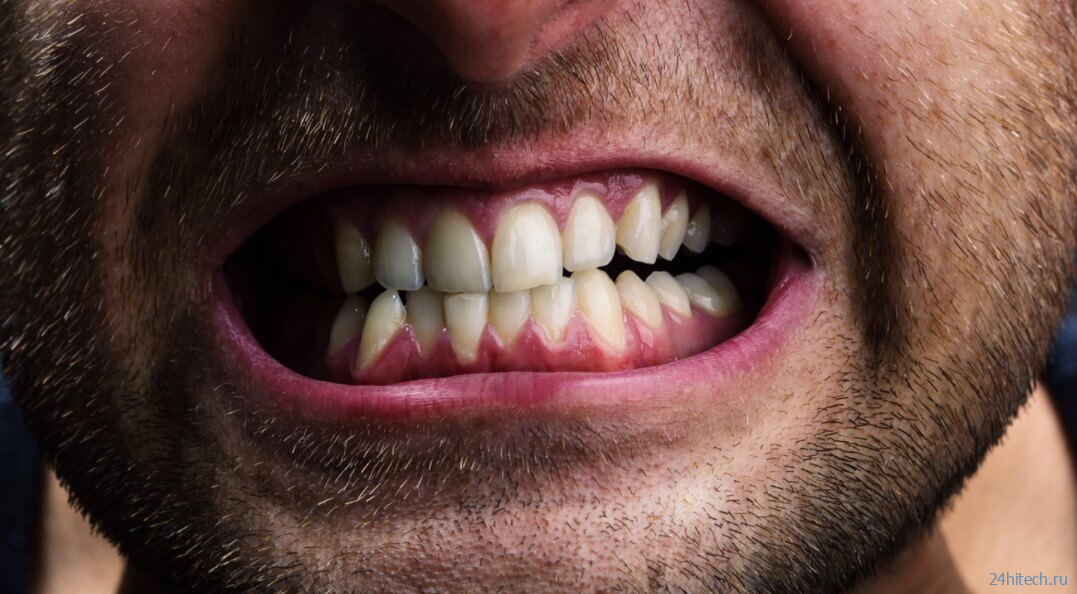 Почему зубы — это не кости? 