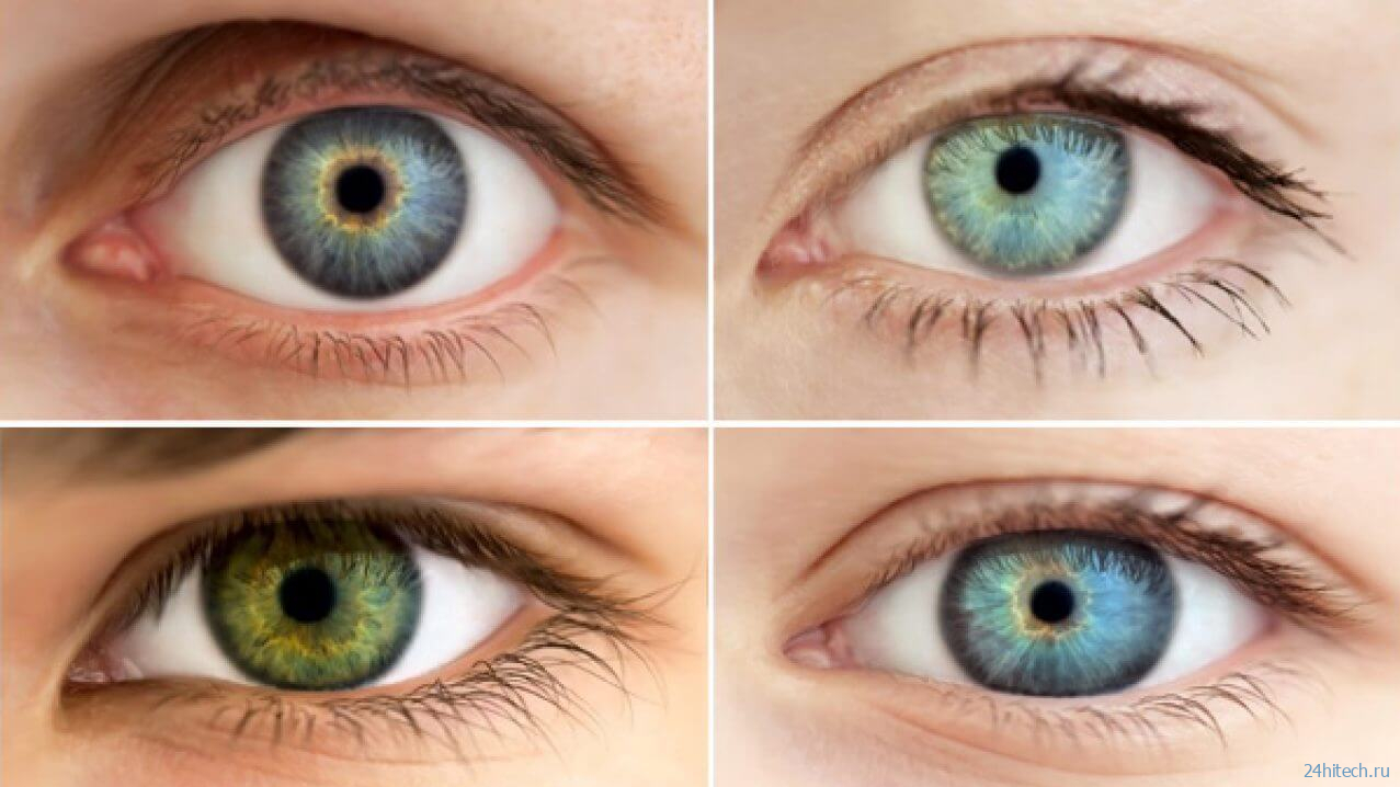 Почему глаза разного цвета и какой цвет самый редкий? 