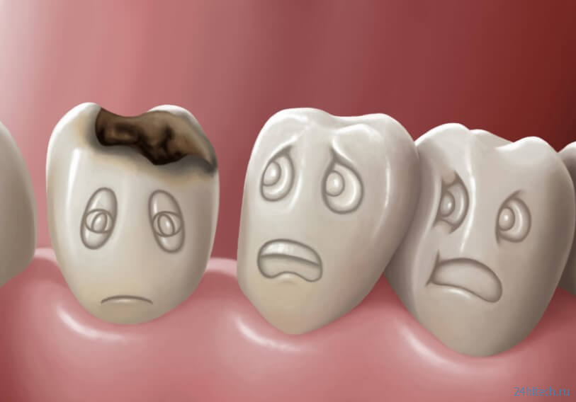 Из-за чего возникает кариес и как защитить зубы? 