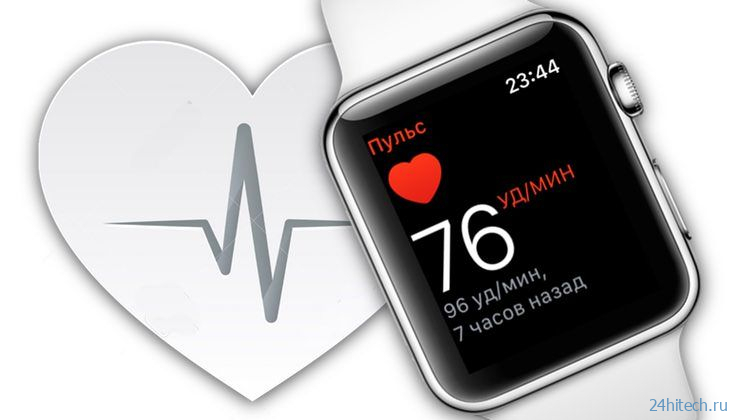 Восстановление пульса: что это, какая норма и как смотреть на Apple Watch и iPhone