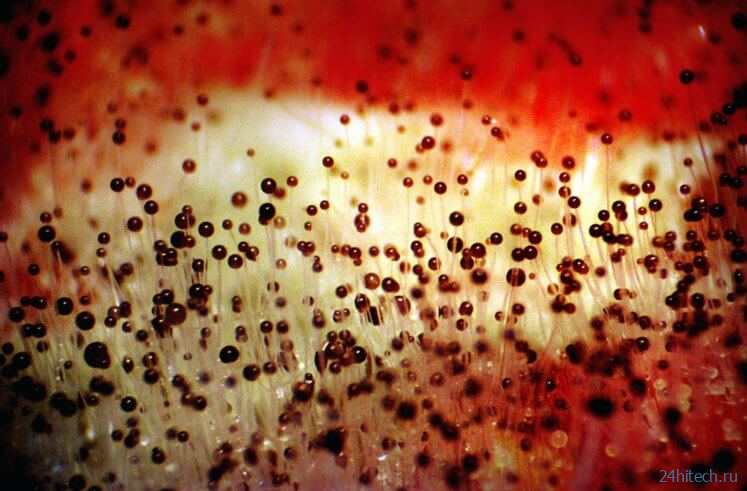 В Индии распространяется мукоромикоз – опасная грибковая инфекция. Что нужно знать? 
