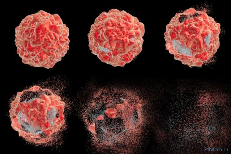 Шотландские ученые изобрели способ, с помощью которого можно убивать раковые клетки 