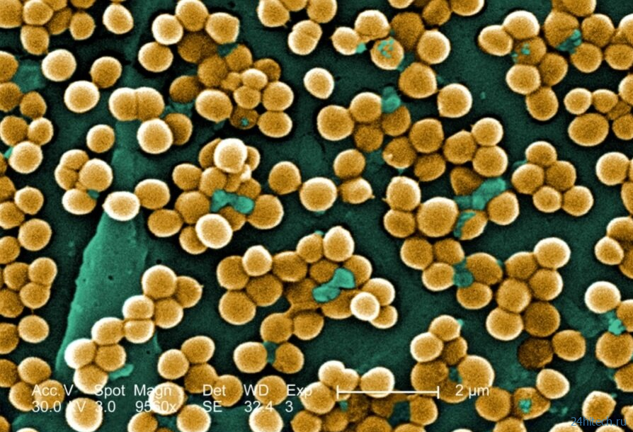 Какие бактерии и насекомые скрываются в вашем постельном белье? 