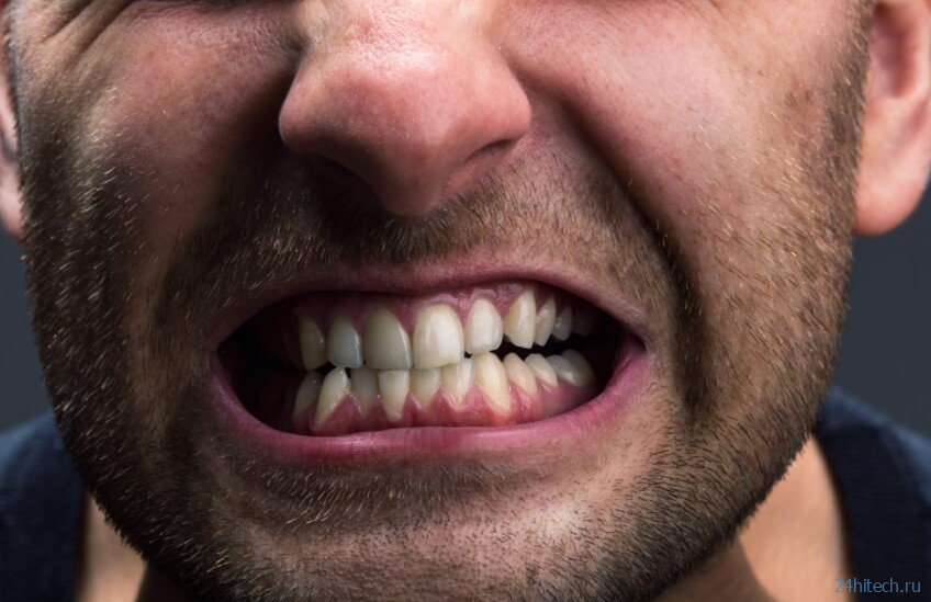 Почему люди скрипят зубами во сне и что с этим делать? 