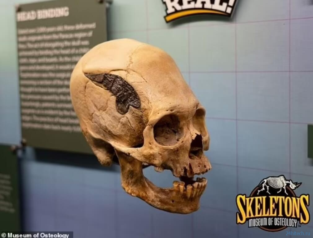 В Перу найден удлиненный череп древнего человека, пережившего сложную операцию 