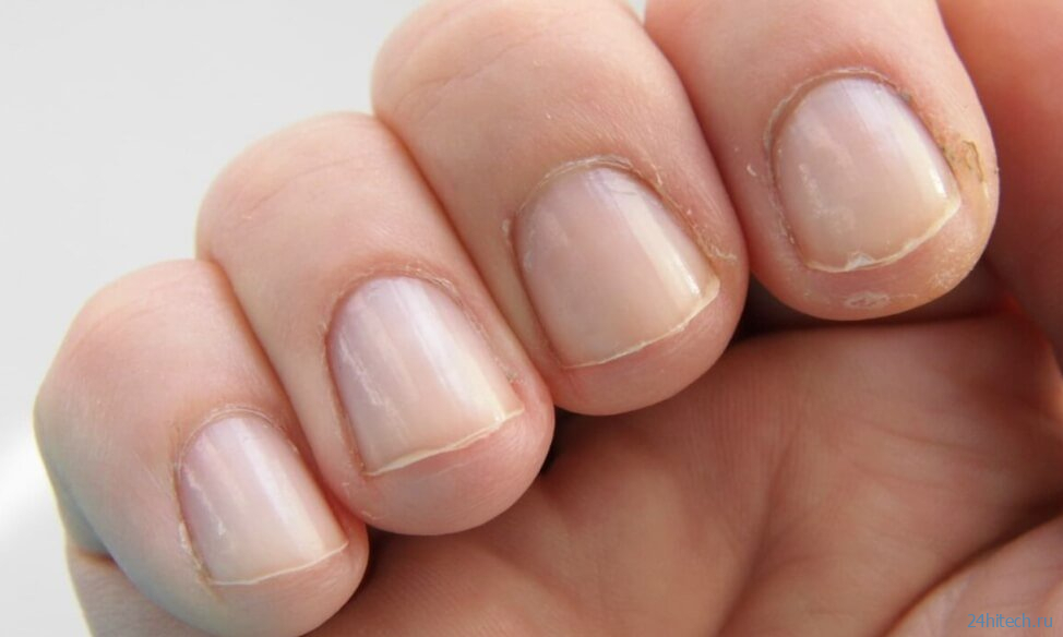 Из чего состоят ногти человека и что они могут рассказать о здоровье?