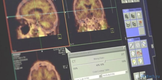 Может ли сканирование мозга объяснить поведение человека?