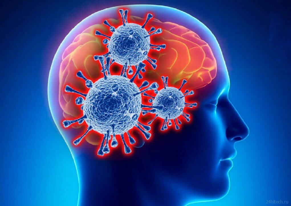 После COVID-19 у людей уменьшается мозг и снижаются умственные способности