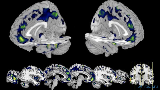 Может ли сканирование мозга объяснить поведение человека?