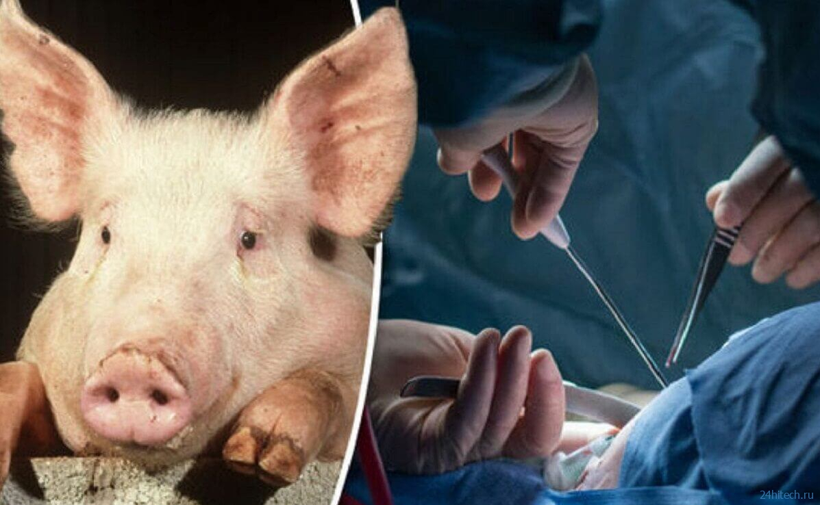 Ученые выяснили от чего умер человек со свиным сердцем