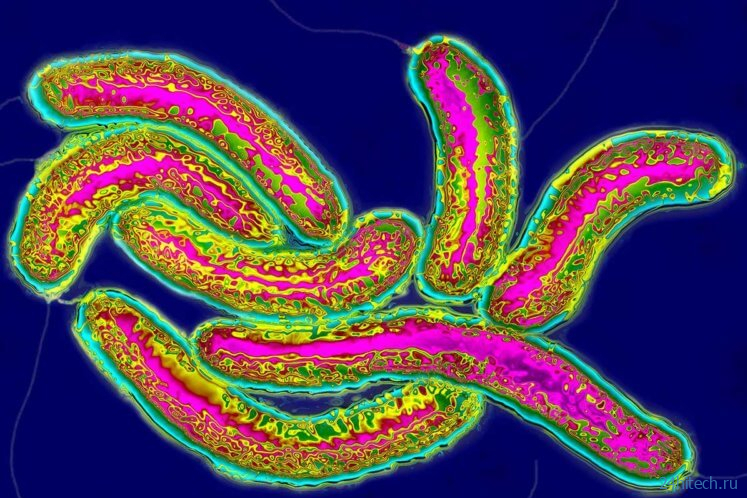 Угроза 2022: что такое холера и насколько она опасна для жизни