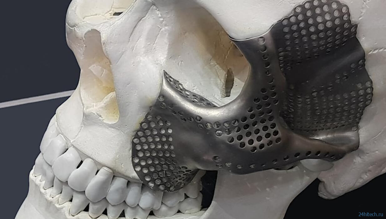 Ученые напечатали на 3D-принтере череп и спасли жизнь ребенку