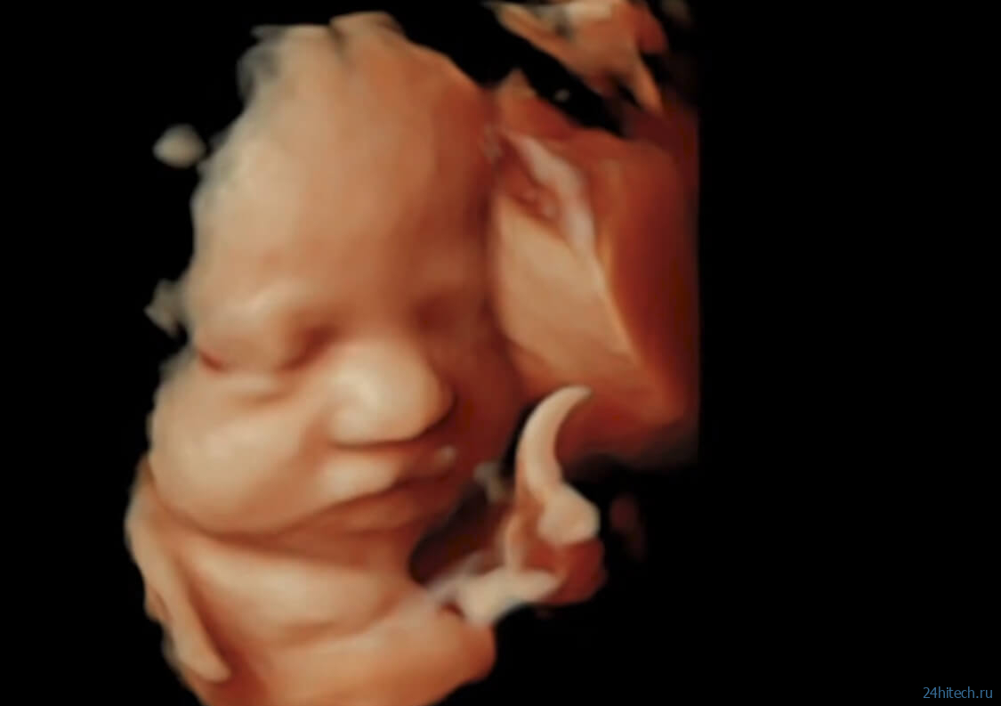 Дети в утробе матери чувствуют запахи и показывают эмоции — смотрите фотографии