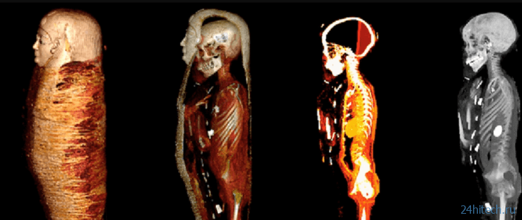 Ученые обнаружили мумию с золотыми изделиями внутри, обеспечивавшими ;магическую защиту