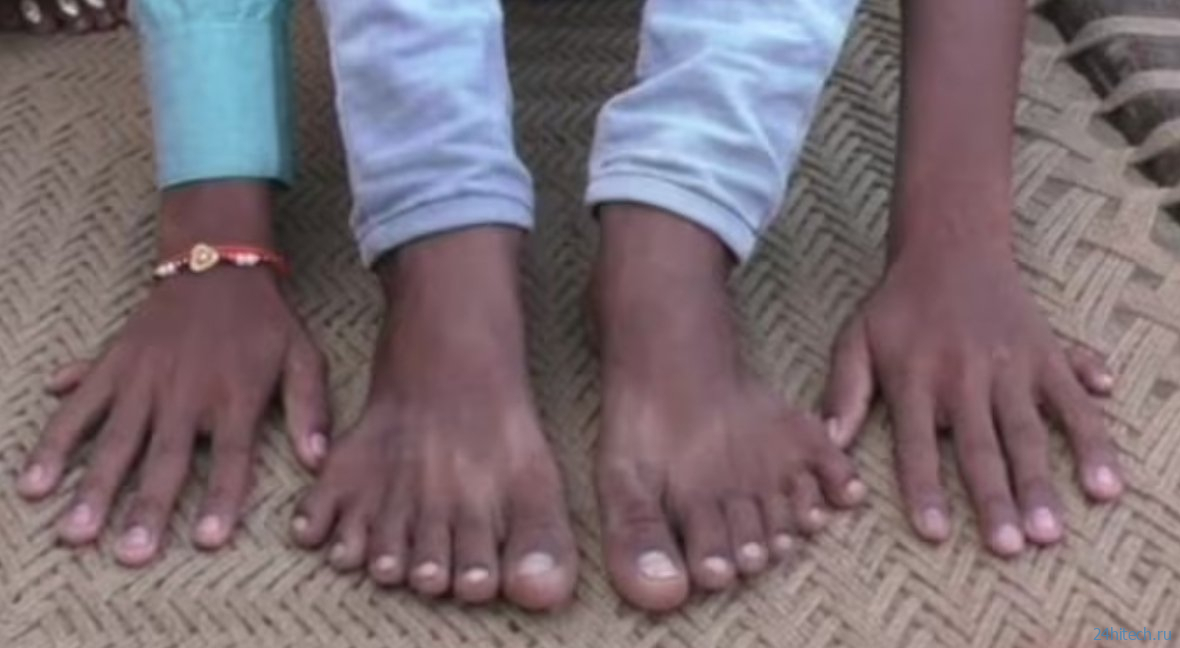 Почему у нас по 5 пальцев на руках и ногах? Почему у нас по 5 пальцев на руках и ногах?
