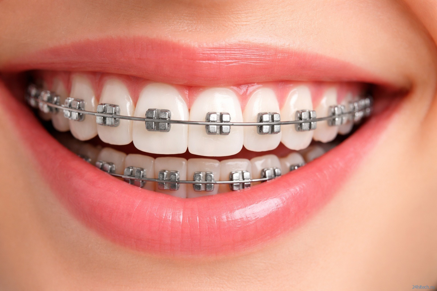 3 признака того, что вы скрипите зубами во сне 3 признака того, что вы скрипите зубами во сне