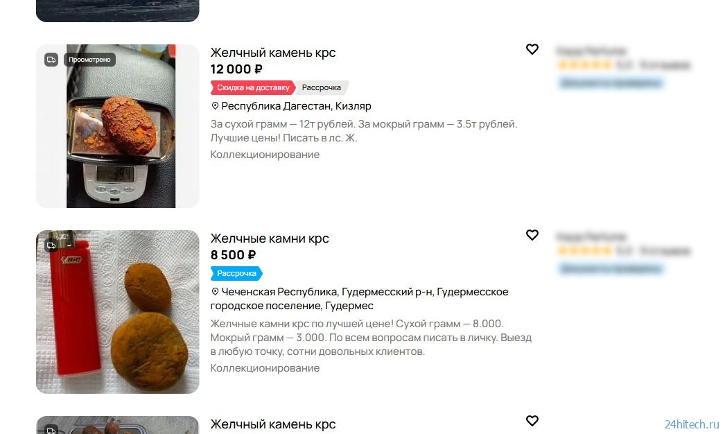 Как россияне продают желчные камни и зарабатывают большие деньги Как россияне продают желчные камни и зарабатывают большие деньги